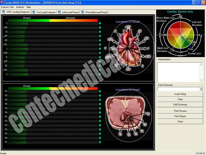 12 lead Resting PC ECG/EKG Workstation System CONTEC  